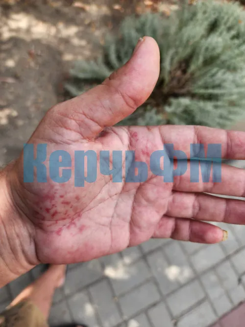В Аджимушкае у дома по Коммунаров, 3 мужчина провалился в канализационный люк