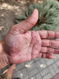 Новости » Криминал и ЧП: В Аджимушкае у дома по Коммунаров, 3 мужчина провалился в канализационный люк